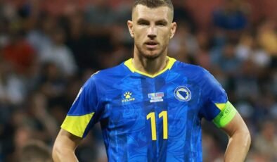 Burnu kırılan Dzeko’dan kahreden haber